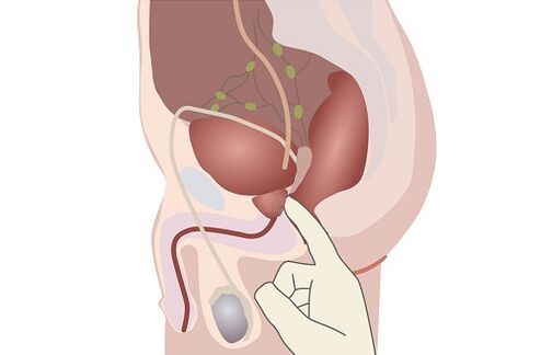 prostatako gizonezkoen anatomia
